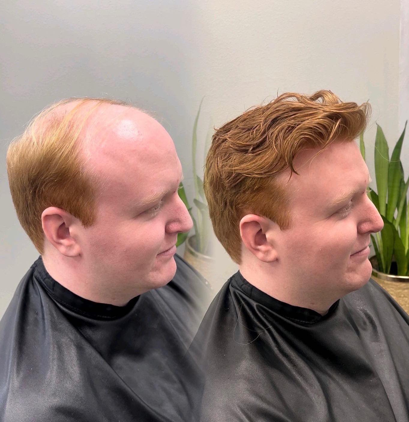 Second before and after hair system example