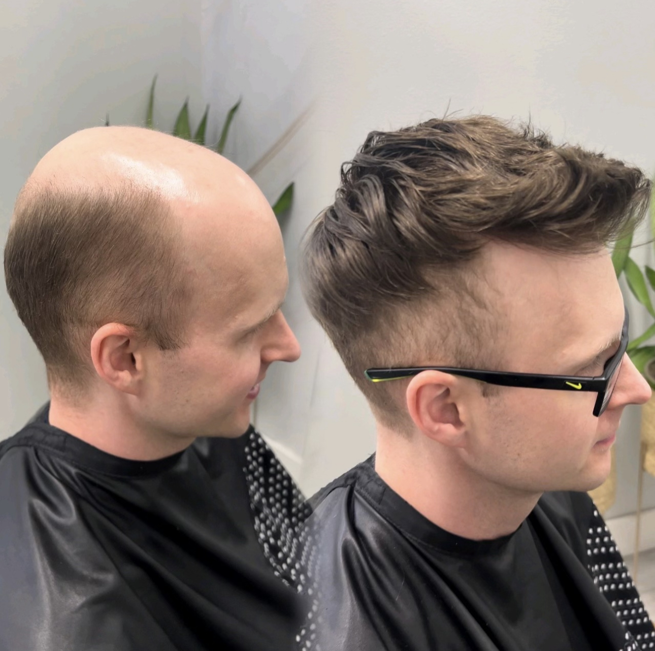 Hair system consultation style example in Bossier City, Louisiana