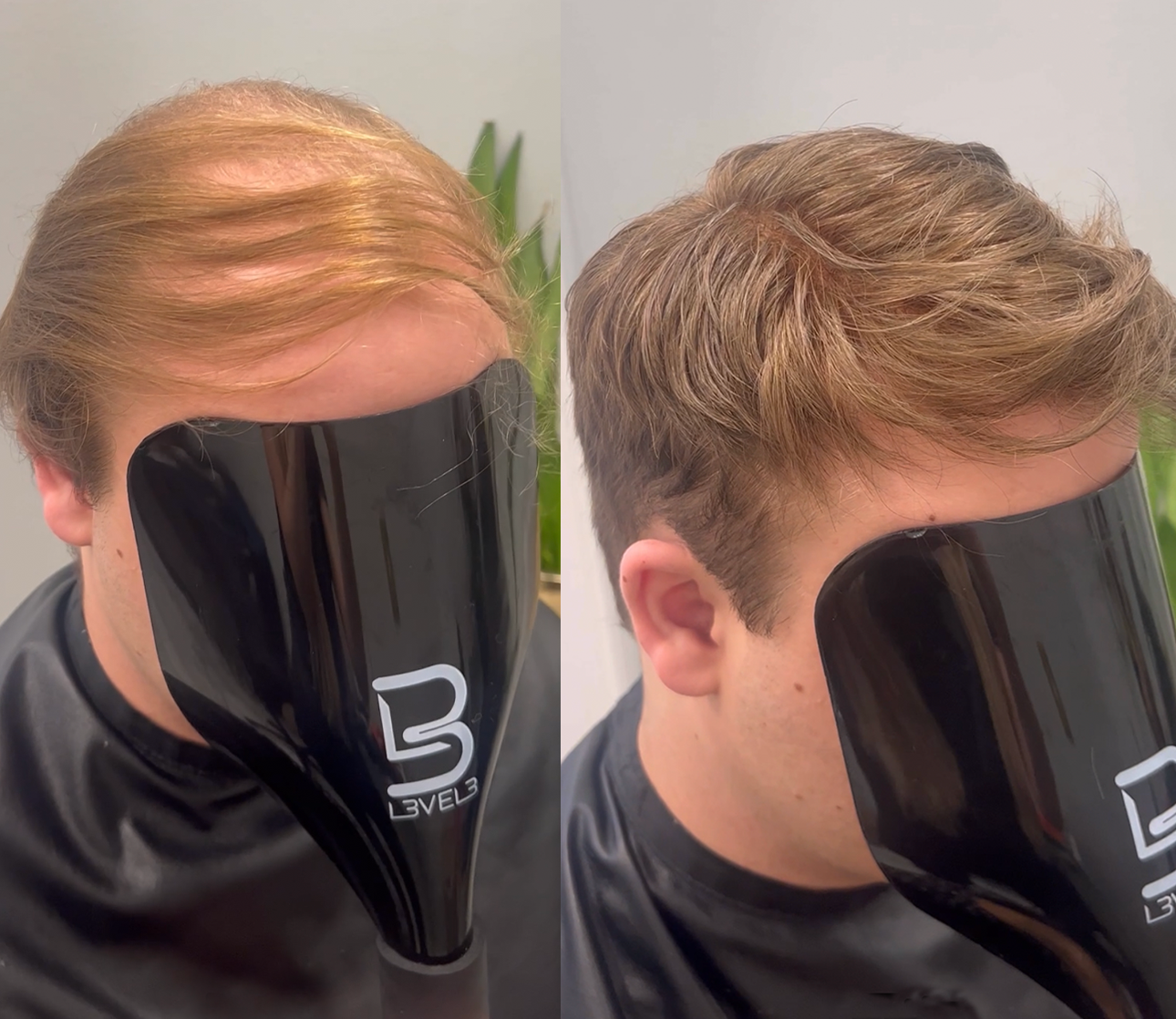 Fuller-looking hair system style example