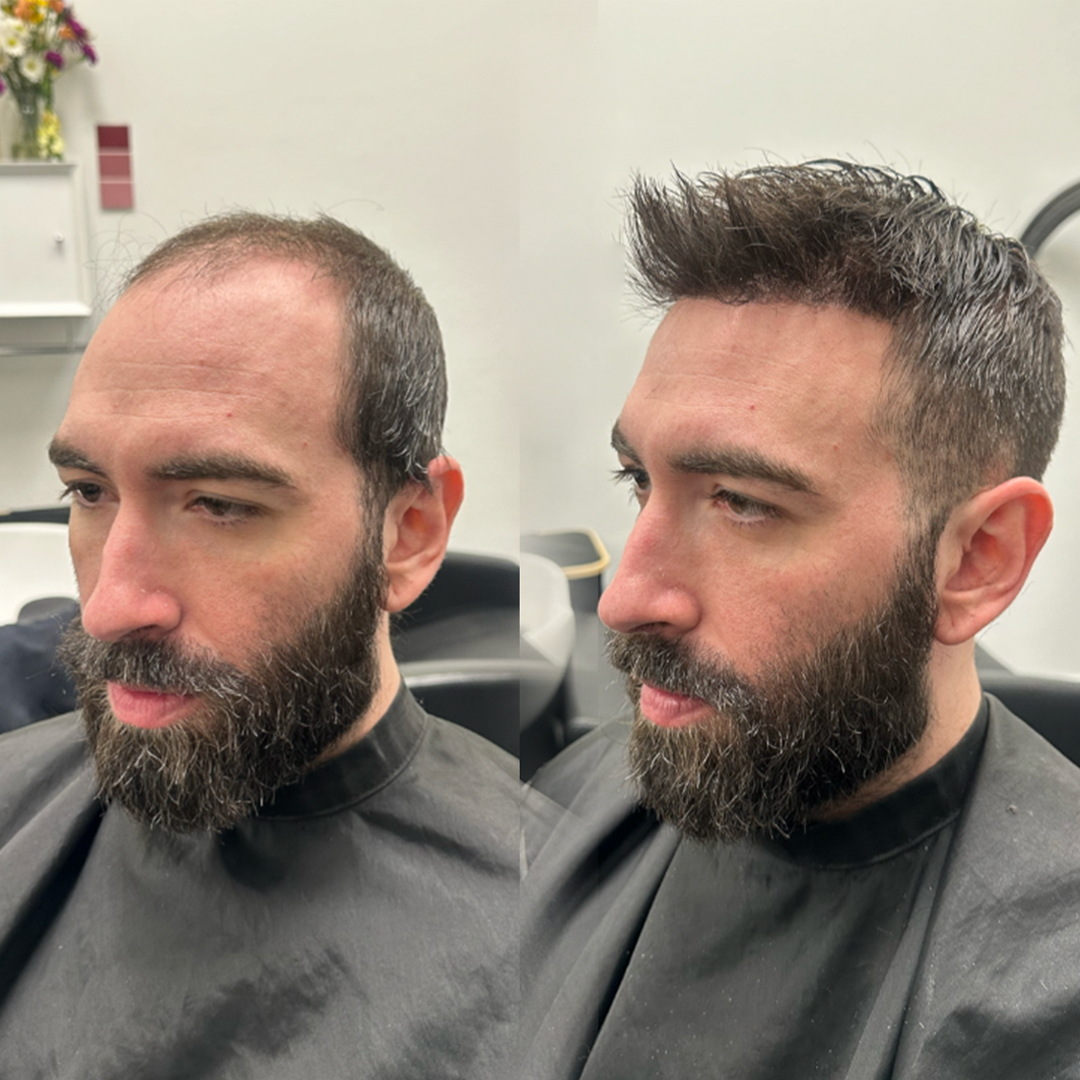 Hair unit coverage example for Bossier City, Louisiana